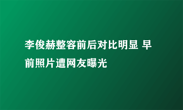 李俊赫整容前后对比明显 早前照片遭网友曝光