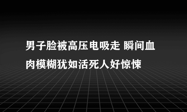 男子脸被高压电吸走 瞬间血肉模糊犹如活死人好惊悚