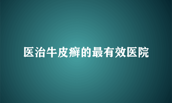 医治牛皮癣的最有效医院