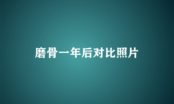 磨骨一年后对比照片