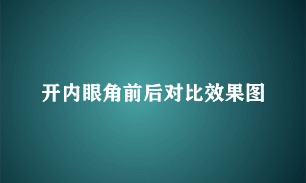 开内眼角前后对比效果图