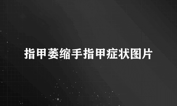 指甲萎缩手指甲症状图片