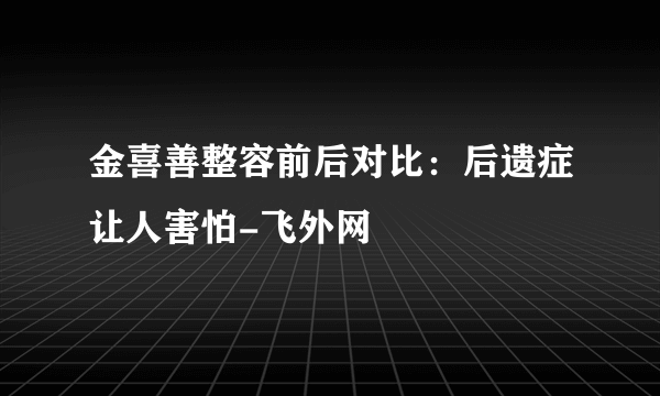 金喜善整容前后对比：后遗症让人害怕-飞外网