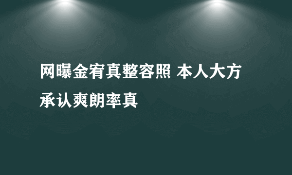 网曝金宥真整容照 本人大方承认爽朗率真