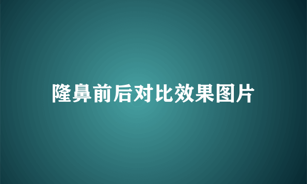 隆鼻前后对比效果图片