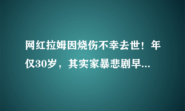 网红拉姆因烧伤不幸去世！年仅30岁，其实家暴悲剧早就有迹可循