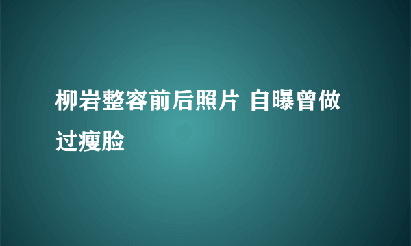 柳岩整容前后照片 自曝曾做过瘦脸