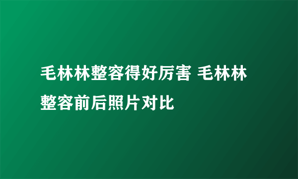 毛林林整容得好厉害 毛林林整容前后照片对比