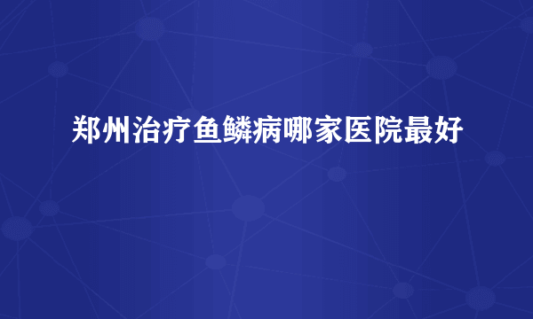 郑州治疗鱼鳞病哪家医院最好