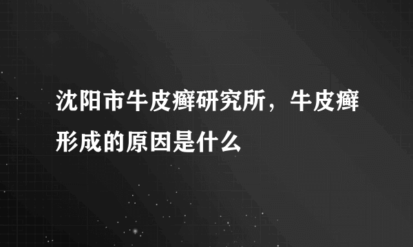 沈阳市牛皮癣研究所，牛皮癣形成的原因是什么