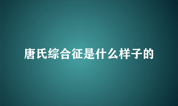 唐氏综合征是什么样子的