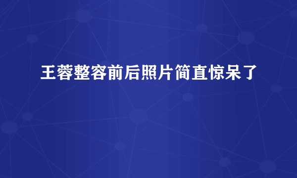 王蓉整容前后照片简直惊呆了