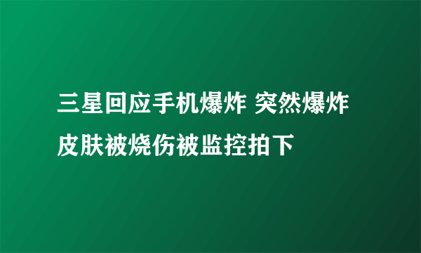 三星回应手机爆炸 突然爆炸皮肤被烧伤被监控拍下