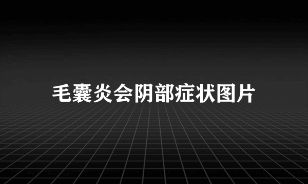 毛囊炎会阴部症状图片