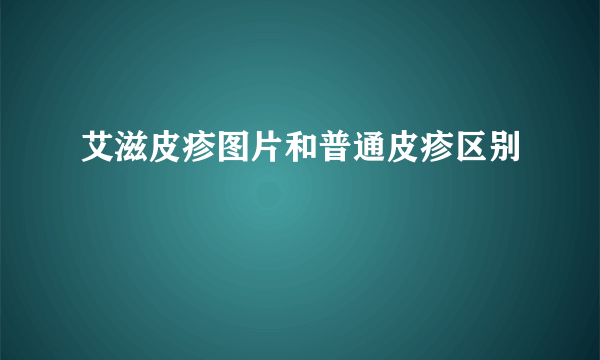 艾滋皮疹图片和普通皮疹区别