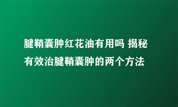 腱鞘囊肿红花油有用吗 揭秘有效治腱鞘囊肿的两个方法