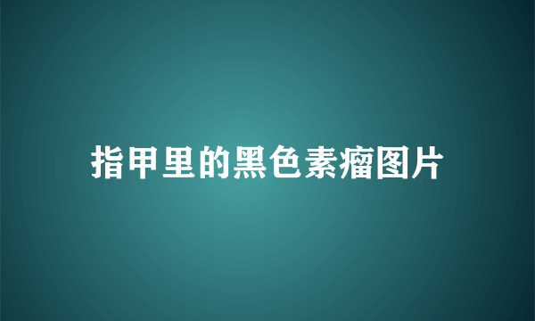 指甲里的黑色素瘤图片