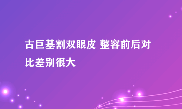 古巨基割双眼皮 整容前后对比差别很大