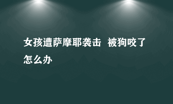 女孩遭萨摩耶袭击  被狗咬了怎么办