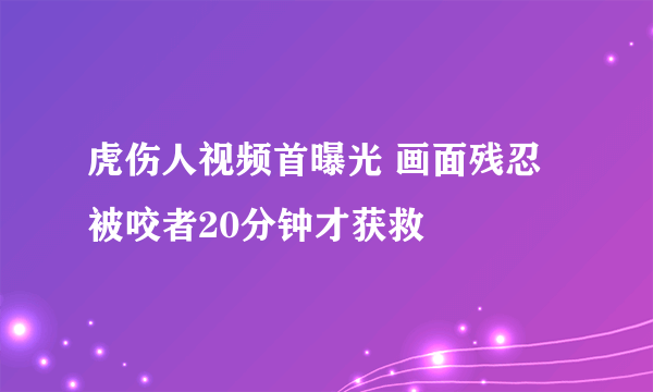 虎伤人视频首曝光 画面残忍被咬者20分钟才获救