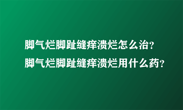 脚气烂脚趾缝痒溃烂怎么治？脚气烂脚趾缝痒溃烂用什么药？