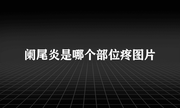 阑尾炎是哪个部位疼图片