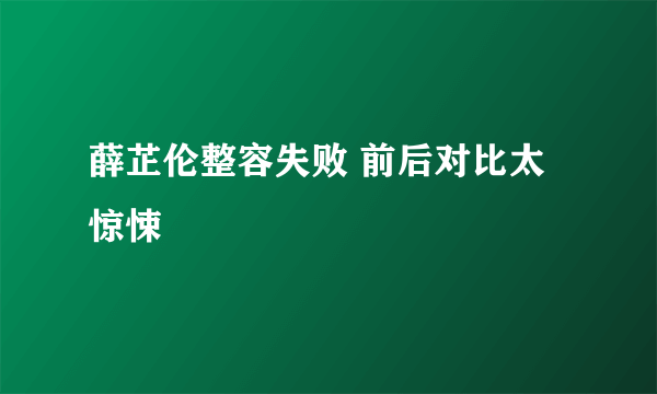 薛芷伦整容失败 前后对比太惊悚