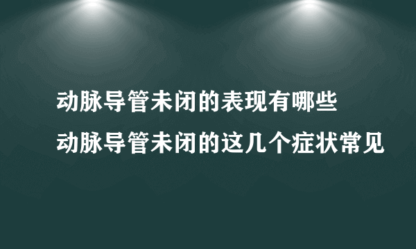 动脉导管未闭的表现有哪些 动脉导管未闭的这几个症状常见