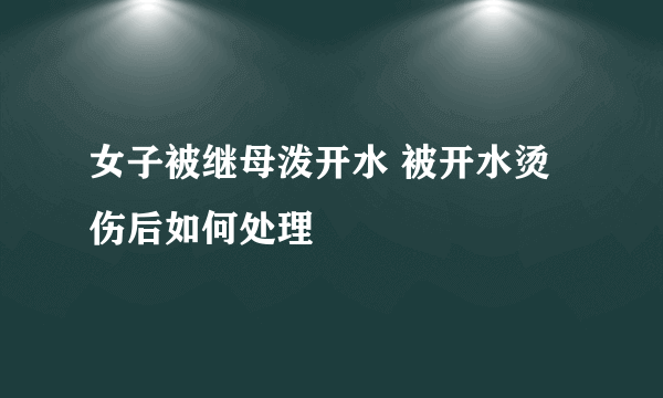 女子被继母泼开水 被开水烫伤后如何处理