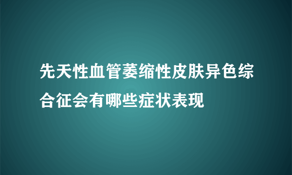 先天性血管萎缩性皮肤异色综合征会有哪些症状表现