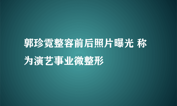 郭珍霓整容前后照片曝光 称为演艺事业微整形