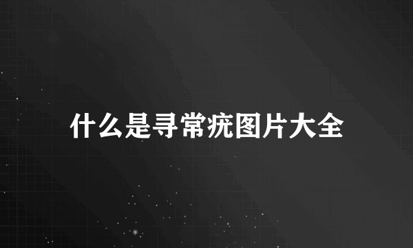 什么是寻常疣图片大全