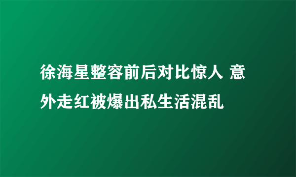 徐海星整容前后对比惊人 意外走红被爆出私生活混乱