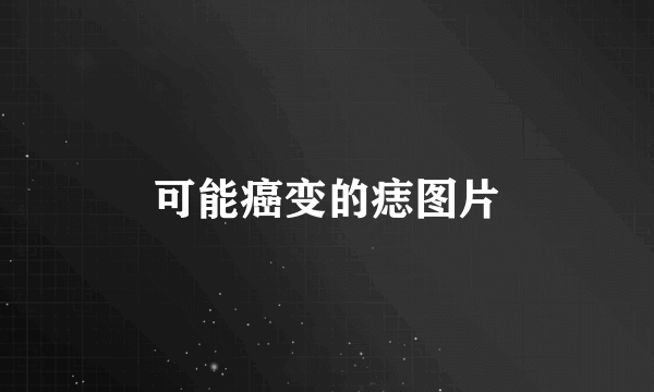 可能癌变的痣图片