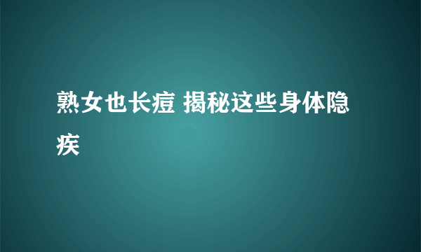 熟女也长痘 揭秘这些身体隐疾