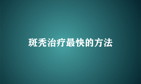 斑秃治疗最快的方法