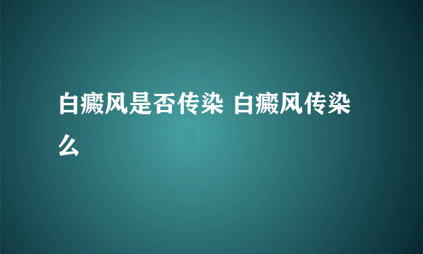 白癜风是否传染 白癜风传染么