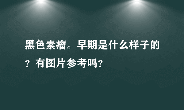 黑色素瘤。早期是什么样子的？有图片参考吗？