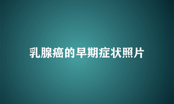 乳腺癌的早期症状照片