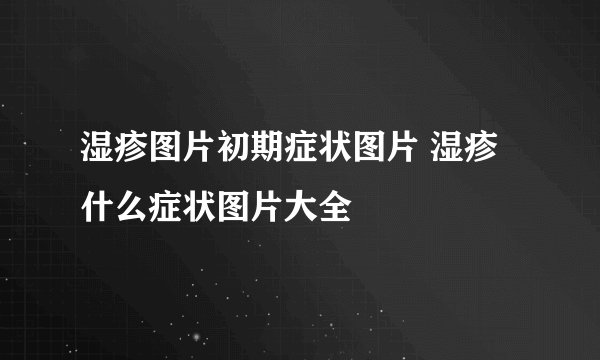 湿疹图片初期症状图片 湿疹什么症状图片大全