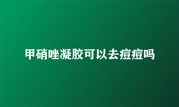 甲硝唑凝胶可以去痘痘吗