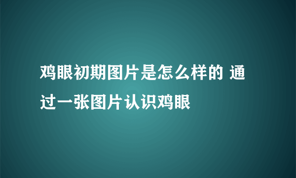 鸡眼初期图片是怎么样的 通过一张图片认识鸡眼