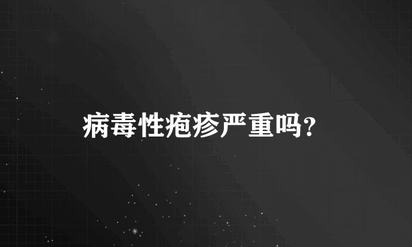 病毒性疱疹严重吗？