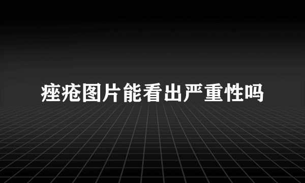 痤疮图片能看出严重性吗