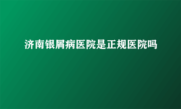 济南银屑病医院是正规医院吗