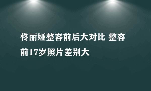 佟丽娅整容前后大对比 整容前17岁照片差别大