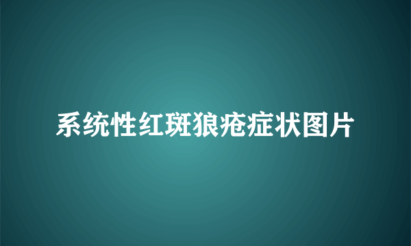 系统性红斑狼疮症状图片