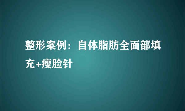 整形案例：自体脂肪全面部填充+瘦脸针