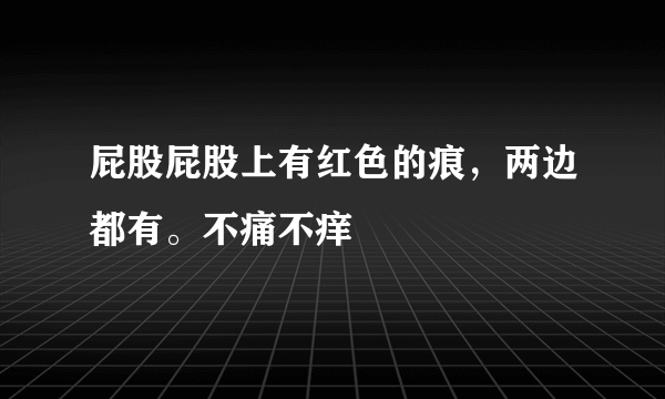 屁股屁股上有红色的痕，两边都有。不痛不痒