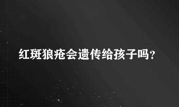 红斑狼疮会遗传给孩子吗？